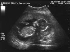 사랑해요, 고마워요, 미안해요. *