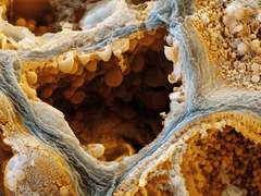 FIXATION OF EXTRACTION #2