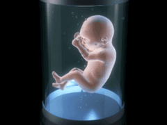 인공자궁을 원하는 아이리스