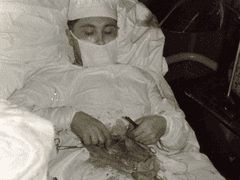 눈매교정 수술방법 중에 제일 문제되는게 근육자르는 전진술입니다