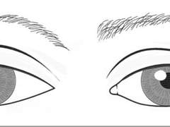 티나는 소시지 아웃라인이나 인아웃을 뽑는 병원의 특징