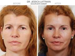 이마거상은 어떤경우에 하는가