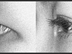 쌍수로 자연스런눈을 원하는데 매몰이 안되는 눈이면 쌍수를 포기하자(이중매몰, 삼중매몰같은 고정센 매몰은 제외->얘네는 눈매교정 부작용 날 확률 높음)