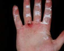 [도플코라] Betrayed Redemption