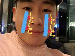 야구일기: 또 속냐?