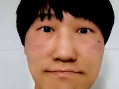 만약 브베 얼굴에 점이 있다면?