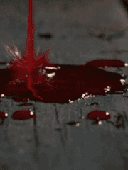 뺑소니당한쇼요