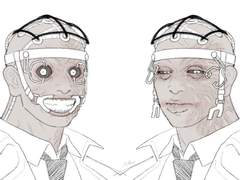 개안기, 개구기 뺀 닥터