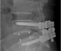 누가 민윤기의 사과를 쪼갤것인가? (중)