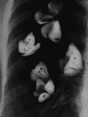 버터플라이 하트