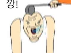 초등학교 1학년때 대가리 깨져서 봉합한 썰