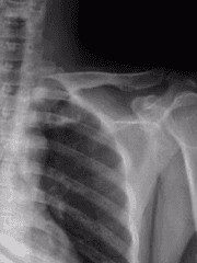 부등호는 언제나