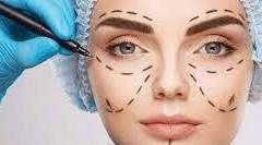 주년 성형 및 시술정보 + 셀카원본