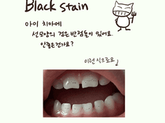 소아치과툰 5화