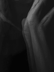 [시리스네] 스키조프레니아