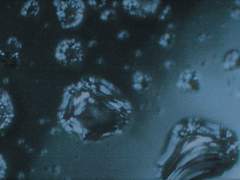 [헤세비나헤세] Endless Rain