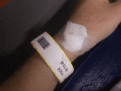 나의 분조장을 못 이겨 응급실 실려간 썰