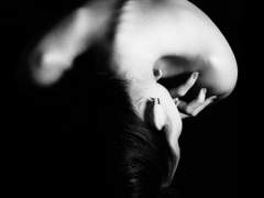 언더 아머 증후군