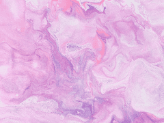 갈라테이아의 선택