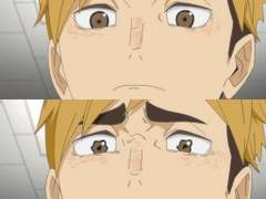 하이큐 드림, 백신 맞고 온 여주(1)