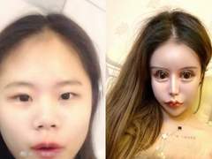 지금까지 내가 한 시술 성형 후기 모음