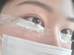 #2. 성형•시술이랑 병원정보 (feat. 가족들 몰래 지방흡입 한 썰)