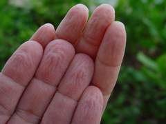 가제. 물에 오래 담겨있던 손가락이 쭈글쭈글 해지는 이유