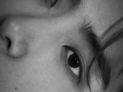 개털 알레르기 08