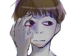 2번째 감자,안구건조