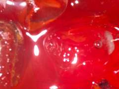 철분 결핍 소녀