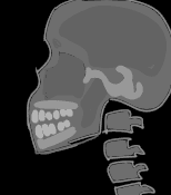 [일기] 턱관절 악화 치료