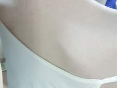 등드름,가드름,모공각화증 홈케어 관리법