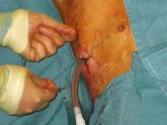 나의 환자 / 10화