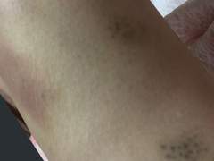 120키로 뚱녀 고깃집 매니저에게 쳐맞고 피멍든 썰