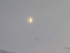 [채햄] 유기현 또 엄살