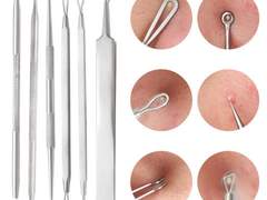 좁쌀 여드름 자극 없이 짜는 법