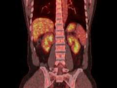 나의 환자 / 15화