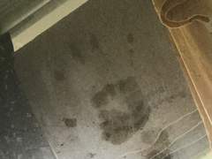 생명선을늘리기위해손바닥을그었다