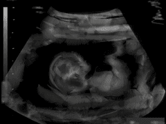 소녀/소년 키우기 [2015-16]