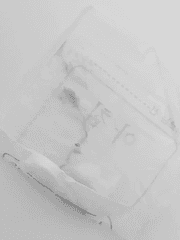 병과 병 바깥의 경계에서