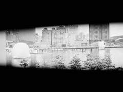 고2병도 불치병