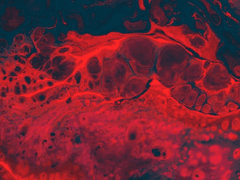 피 말리는 사랑 1화