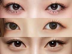 [눈 편] 예쁜 무쌍인데 쌍수할까 말까에 대한 해답