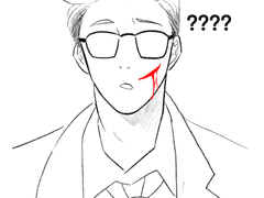 얼굴 상처난 준구