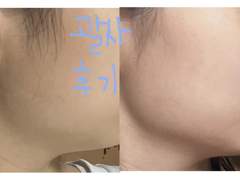 괄사사용하고 피부하얘진 후기 (루틴소개)