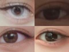 쌍수 ㅈㄴ잘되는법