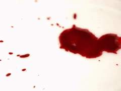 벨라트릭스 이라 | 13 | 에피테시