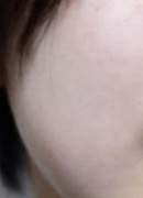 민감성 여드름 피부 꿀피부 만들기(홈케어 위주)