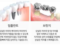 오징어 먹다가 브릿지 빠진 정대만