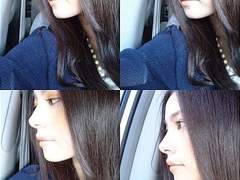 성형을 망설이는 당신들께